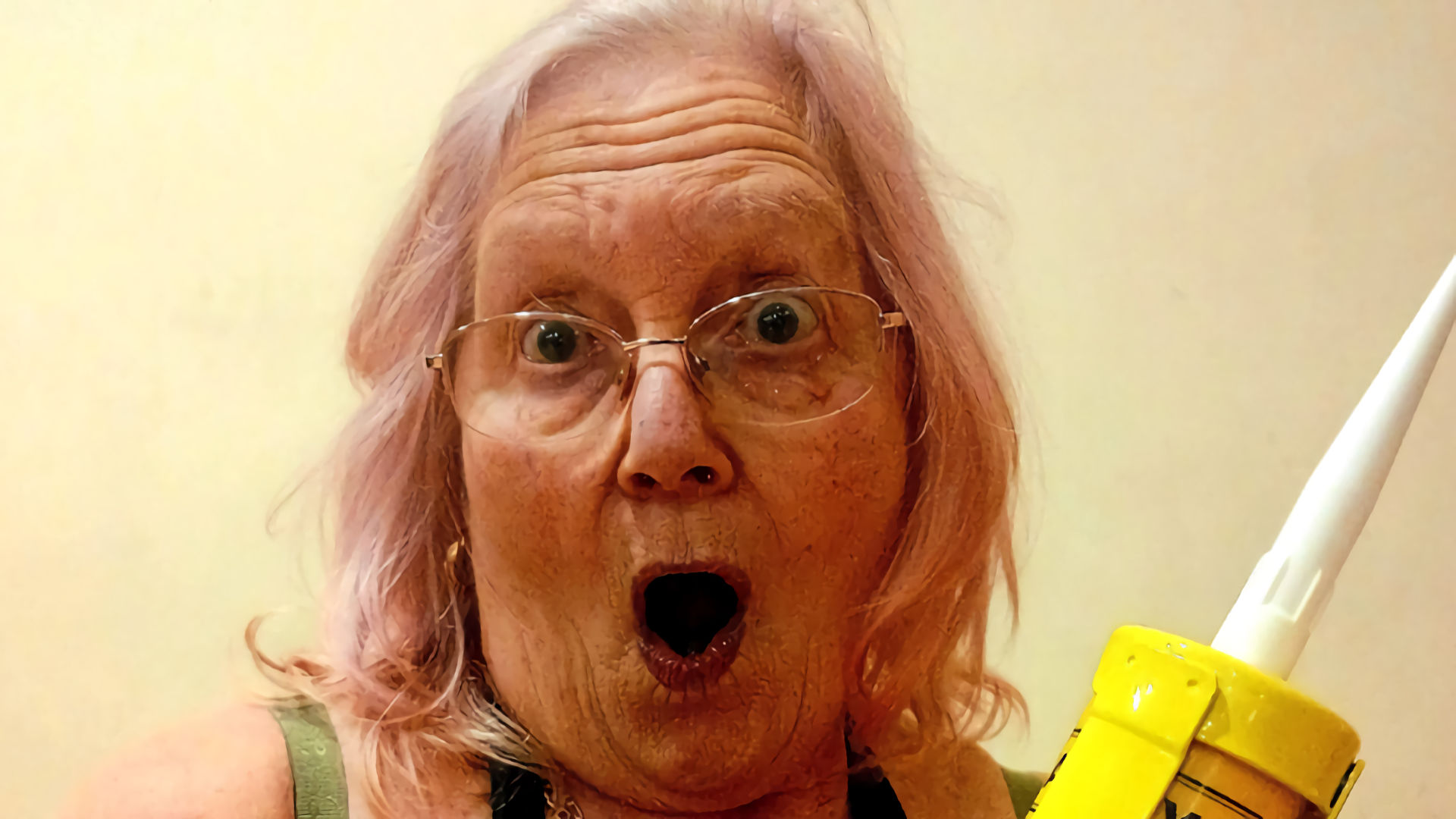 Nanna Mo's Botox and Bum Lifts