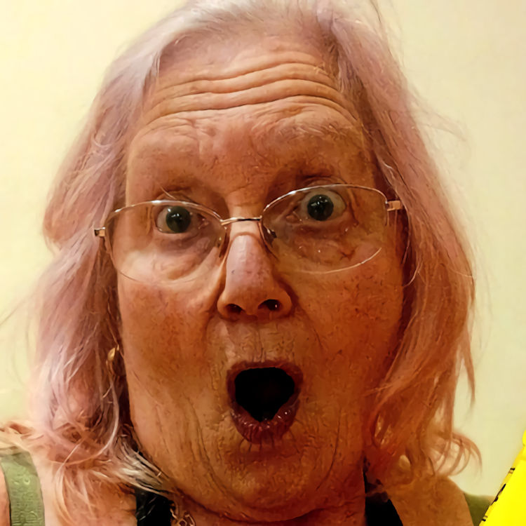 Nanna Mo's Botox and Bum Lifts
